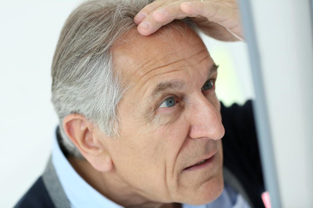 Finding Great Hair Loss Treatment For Seniors
